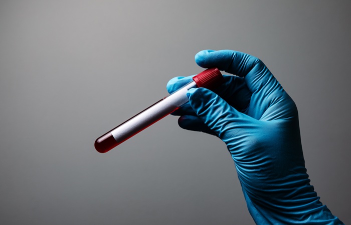 Sintomas-da-anemia-cansaco-constante-pode-ser-um-sinal-de-alerta-